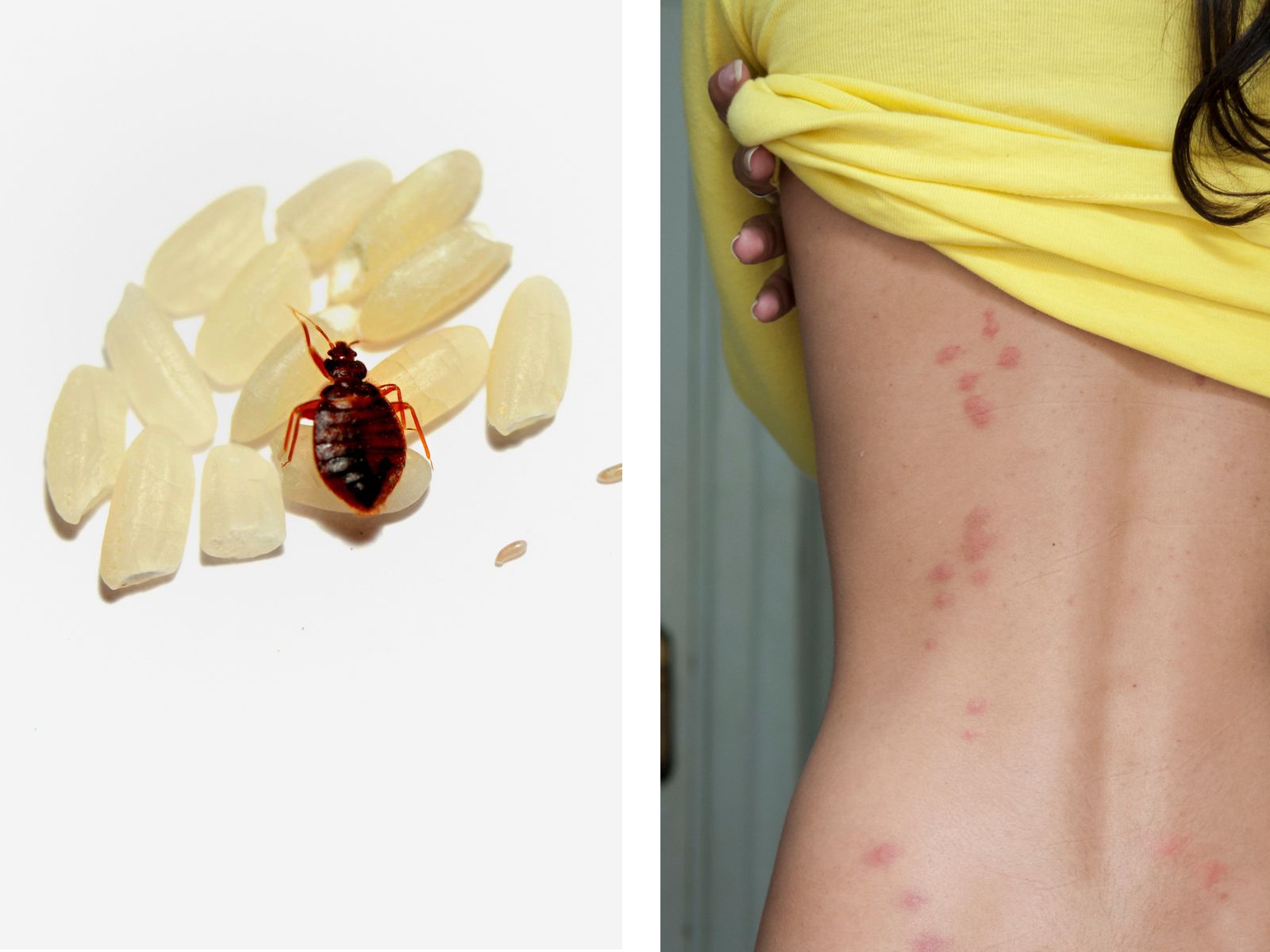 Bedwantsen-afmeting- symptoom